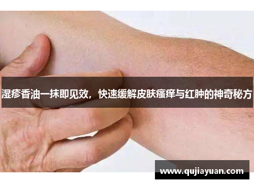 湿疹香油一抹即见效,快速缓解皮肤瘙痒与红肿的神奇秘方 湿疹香油一抹即见效,快速缓解皮肤瘙痒与红肿的神奇秘方