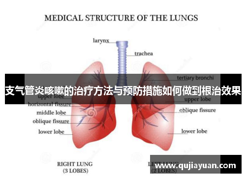 支气管炎咳嗽的治疗方法与预防措施如何做到根治效果